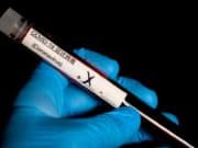 Нови 7 случая на коронавирус у нас