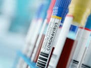 11 нови случая на COVID-19 в община Панагюрище