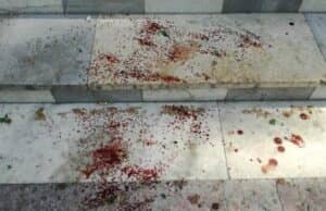 Пореден случай на домашно насилие: Този път жена намушка с нож съпруга си