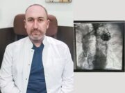 За първи път в „Уни Хоспитал“ приложиха физиологична кардиостимулация